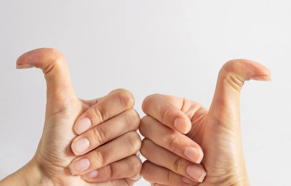 Ehlers-Danlos and Hypermobility