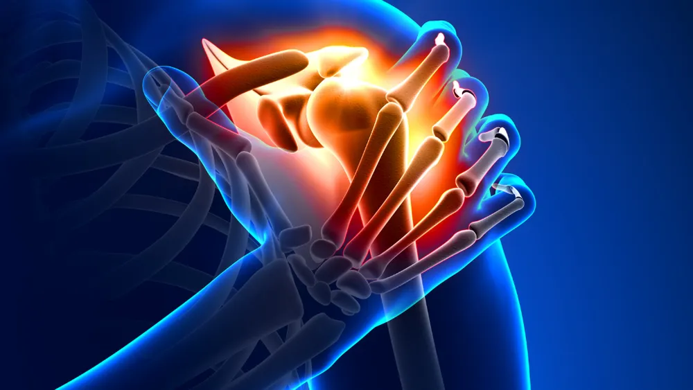 Snatches & Shoulders