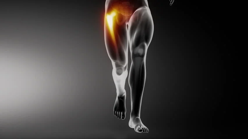 Help! I have Anterior Hip Pain with Squats