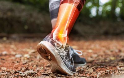 Running Injury in Jacksonville: #1 Mistake and How to Fix It