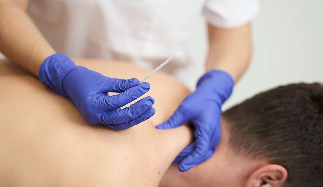 9 Reasons Athletes Trust Motion RX’s Dry Needling Therapy to Recover Faster