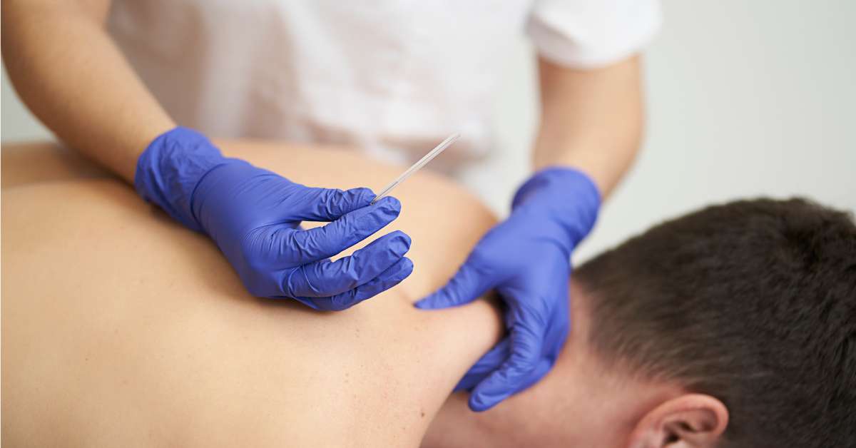 9 Reasons Athletes Trust Motion RX’s Dry Needling Therapy to Recover Faster
